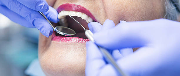 Best Emergency Dentist for Knocked-Out Tooth in Long Beach, NY